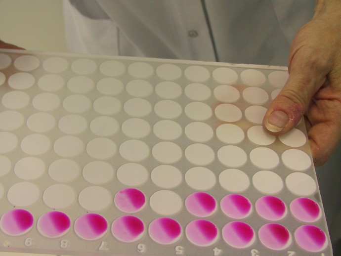 « Il arrive qu’on ait de mauvaises surprises ». Conservé jusqu’à 5 jours à une température constante de 30 °C, l’échantillon a révélé ici la présence d’une bactérie infectieuse : la salmonelle.