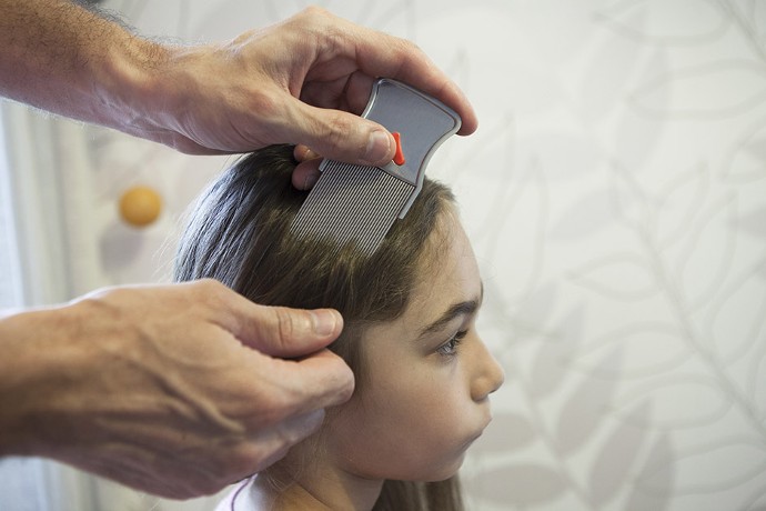 85 % des enfants auraient des poux au moins une fois durant leur scolarité